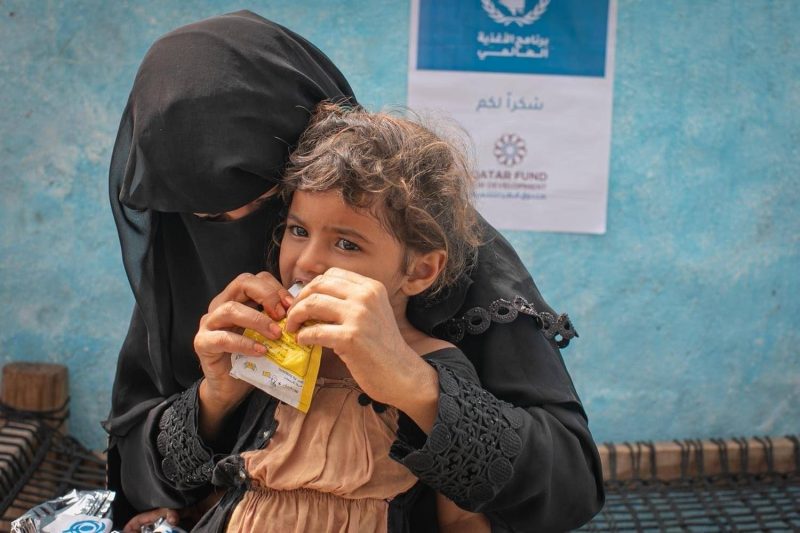 الأغذية العالمي: سوء التغذية الحاد باليمن ما زال يشكل تهديدًا خطيرًا على حياة الأشخاص