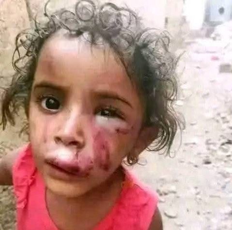 امرأة تعذب طفلتها بطريقة وحشية في تعز