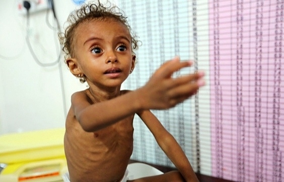 الأمم المتحدة: الأسر اليمنية تعاني من الجوع والنزوح وانعدام الأمان