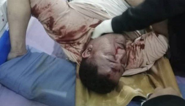 خلاف بين مواطنين يتسبب في مقتل شخص وإصابة آخرين بوادي المعسل