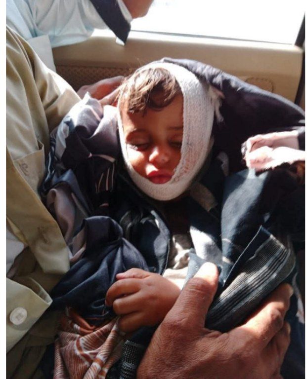 عصابة مجهولة تحرق منزلًا في تعز وتقتل طفلًا