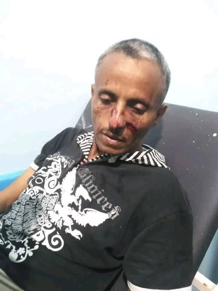 تعز.. قتلى وجرحى بإطلاق نار في سوق شعبية