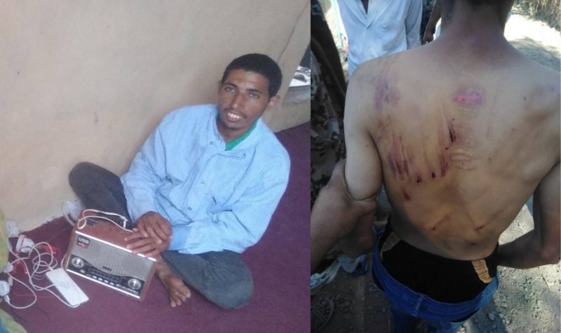 اعتداء وحشي على شاب معاق في تعز يثير غضبًا شعبيًا ومطالب بالقبض على الجاني