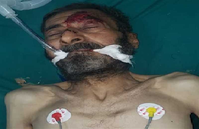 صنعاء.. وفاة مواطن في حادثة دهس