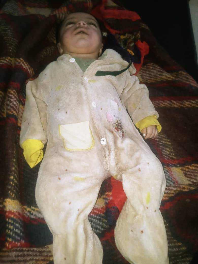 نتيجة الأمطار.. وفاة طفل وإصابة 7 أشخاص جراء انهيار منزل في إب