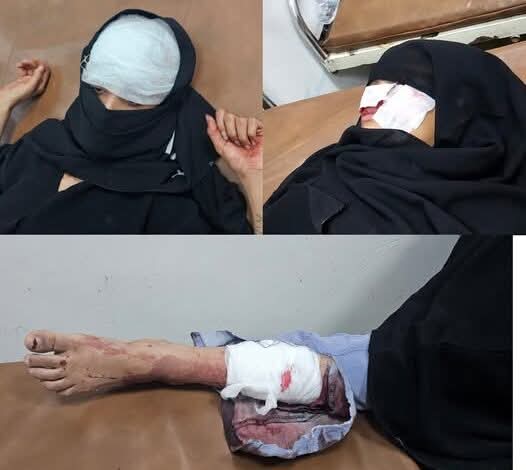 إصابة 3 فتيات بقصف مدفعي غرب تعز