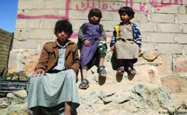 يونيسف: 69% من أطفال محافظة ريمة يعانون من التقزم