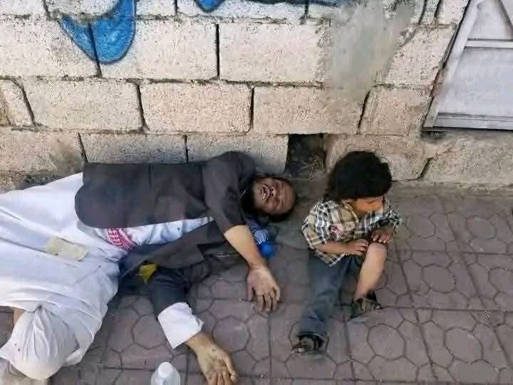 مأساة في إب: مواطن يمني يفارق الحياة من شدة الجوع على الرصيف أمام طفله