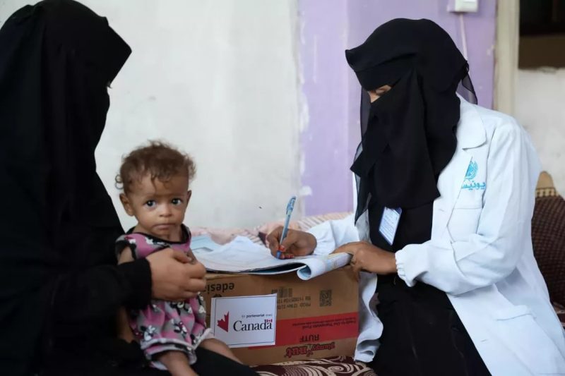 اليونيسف تكشف عن معدلات تقزم مأساوية للأطفال في اليمن