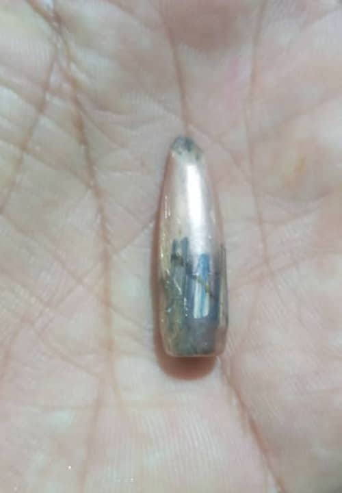 حضرموت.. إصابة طفلة برصاص راجع