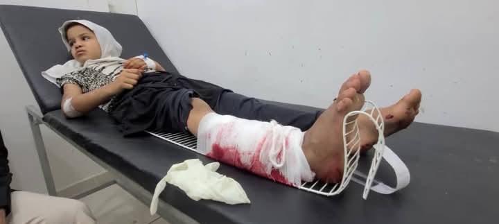 إصابة طفلة برصاص قناص شرقي تعز