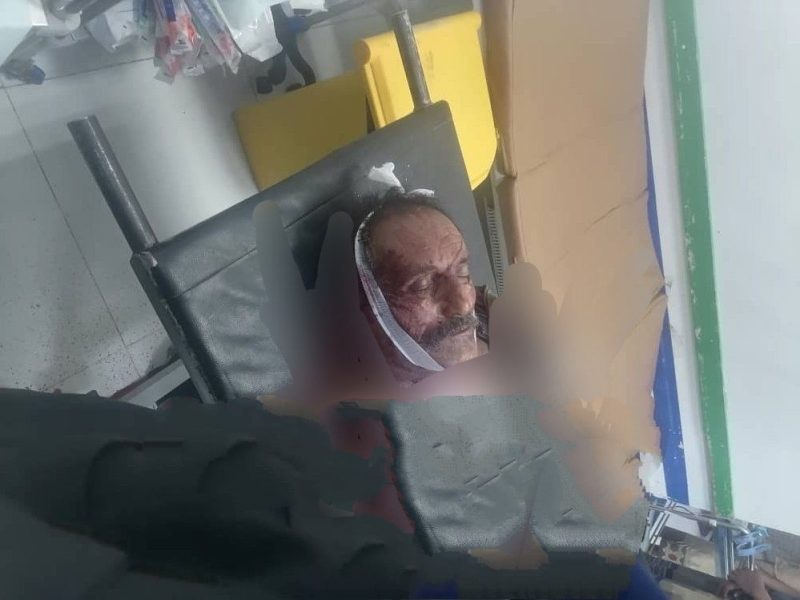 مقتل مواطن في عتق والأجهزة الأمنية تشدد الإجراءات