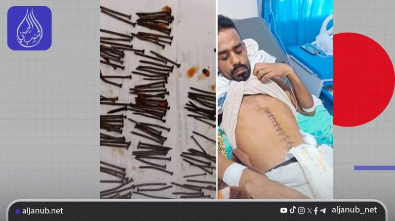 استخراج إبرة و117 مسمارًا من بطن مواطن في لحج يثير دهشة الأطباء