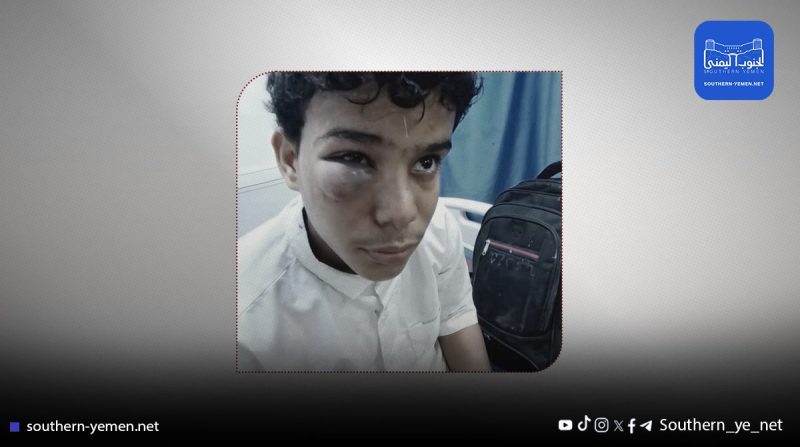 اعتداء على طفل في محيط أمن المكلا يثير غضبًا شعبيًا ومطالبات بالتحقيق العاجل