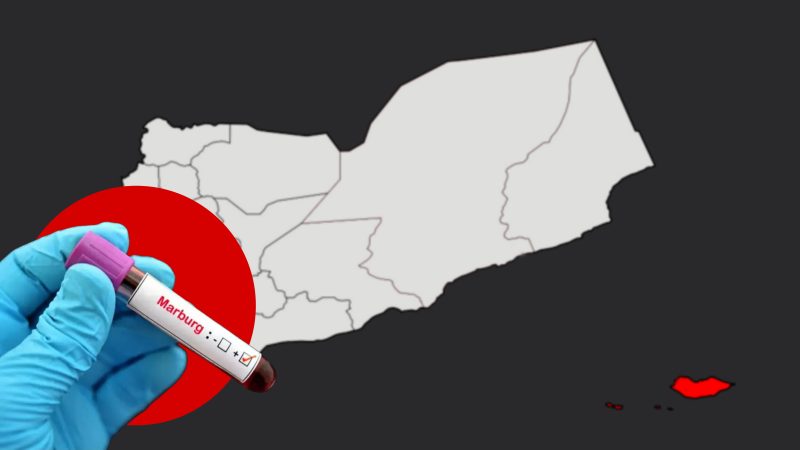 خطر بيولوجي.. تحذيرات من تفشي ماربورغ واليمن في دائرة الخطر