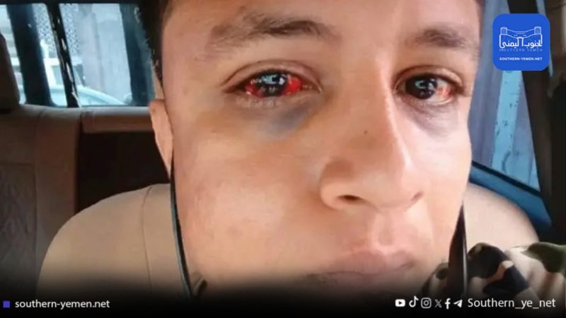 “أدخل أصابعه في عيني”.. حادثة مروعة تكشف واقع السجون في عدن